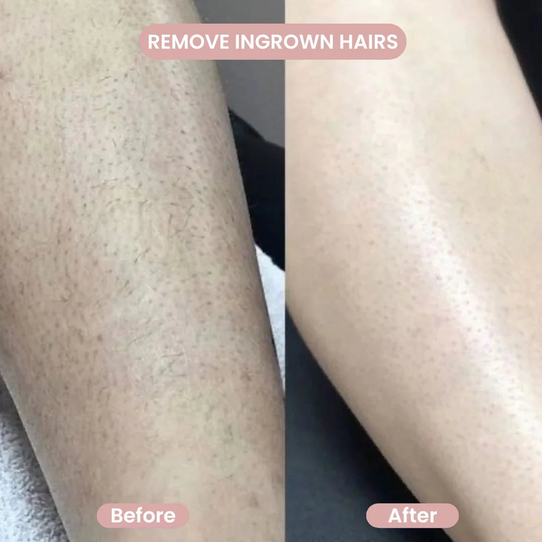 Delika™ Rasuradora Delicada 2 en 1 para Bikini y Cuerpo