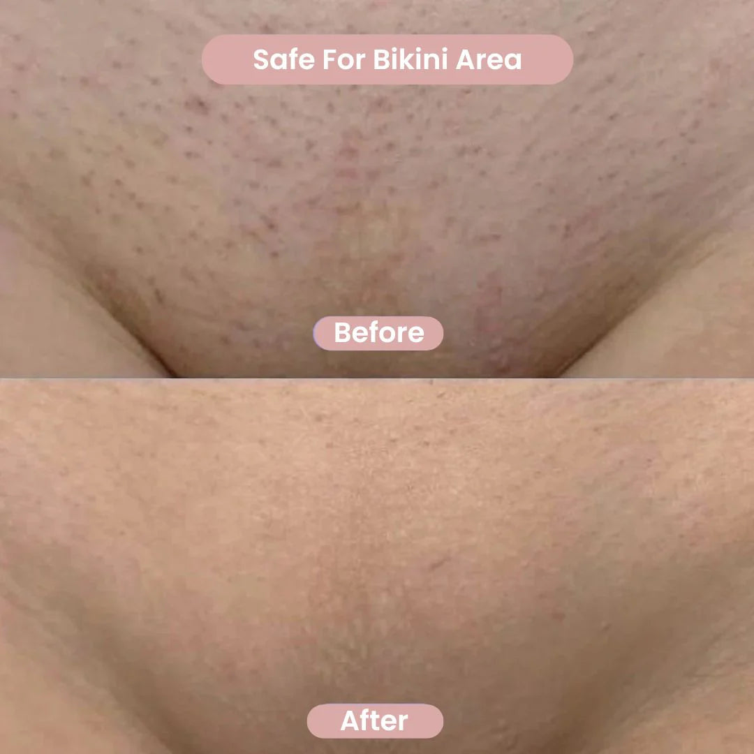 Delika™ Rasuradora Delicada 2 en 1 para Bikini y Cuerpo
