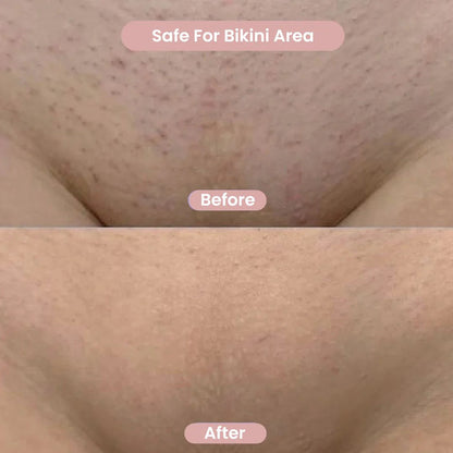 Delika™ Rasuradora Delicada 2 en 1 para Bikini y Cuerpo